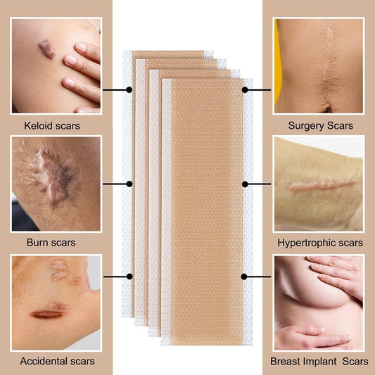 Silicone Scar Sheets, Soften and Flattens Scars Resulting Scare Remover from Surgery, Injury, Burns, C-Section (4 Pcs)